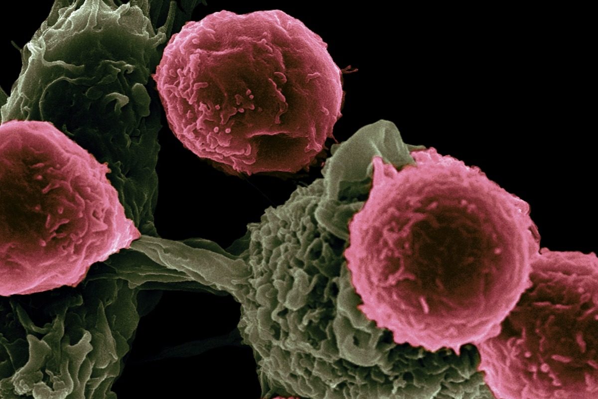 Photo of Izraelskí vedci objavili biologický kontrolný systém, ktorý dokáže zabrániť rakovine v ľudských bunkách