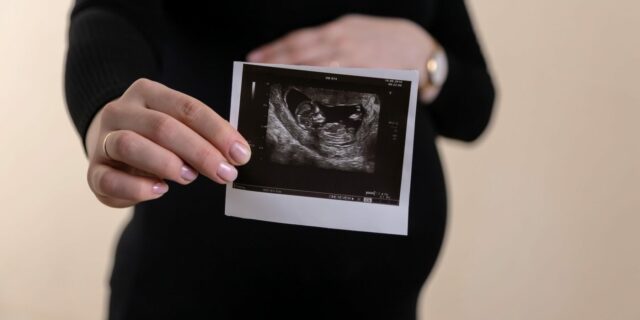 sarcina, copil, avort, bebelus, gravida, echografie, fetus