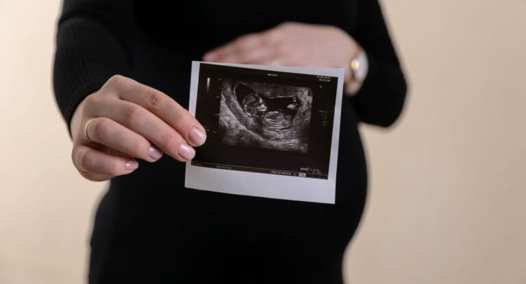 sarcina, copil, avort, bebelus, gravida, echografie, fetus