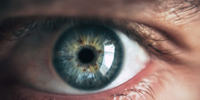 retina ochi scanare
