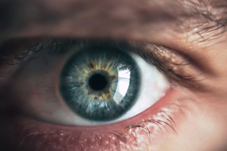 retina ochi scanare