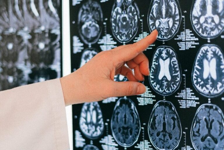 creier radiografie tesut cerebral rmn tomograf
